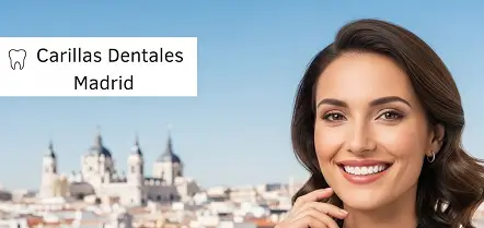 Carillas dentales en Madrid