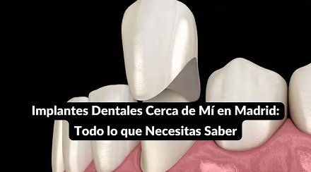Procedimiento de implante dental y corona