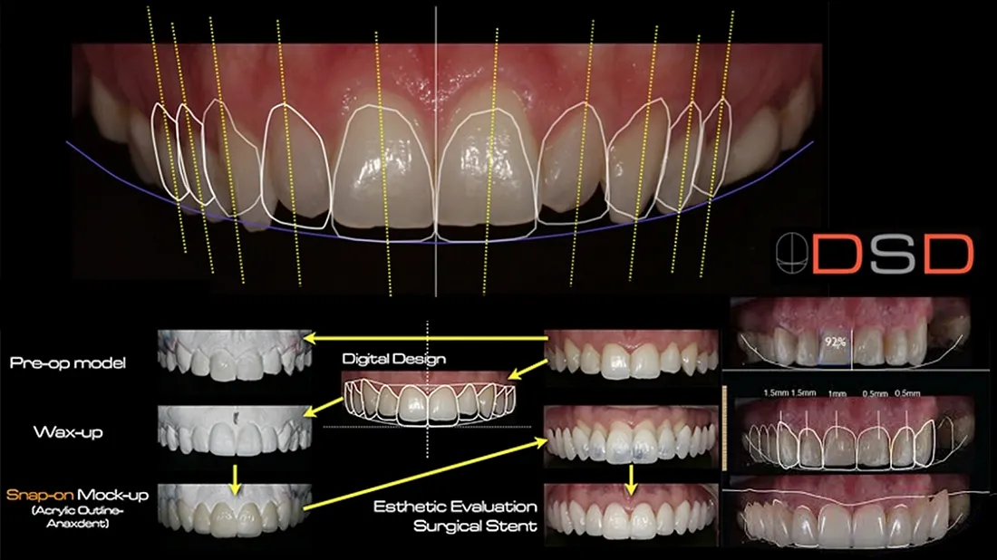 analisis estetico sonrisa digital