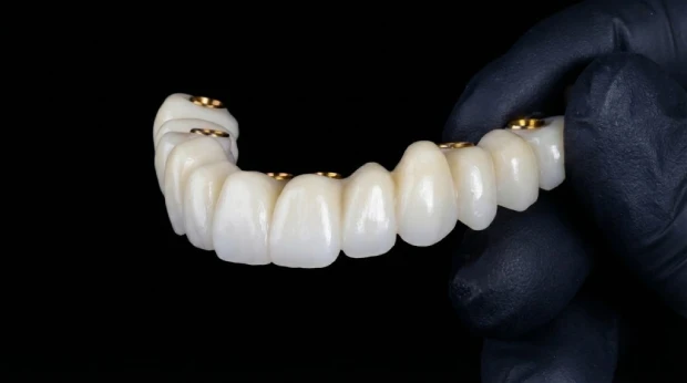 tratamiento implantes carga inmediata