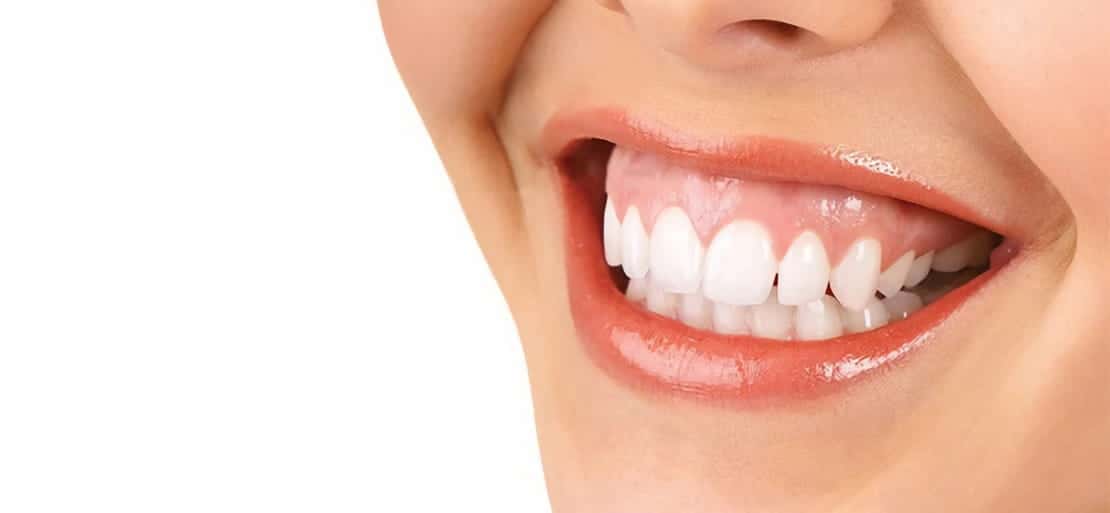 tratamiento sonrisa gingival